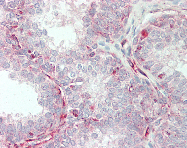 Human Prostate: Formalin-Fixed, Paraffin-Embedded (FFPE)