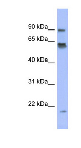 LRRFIP1 antibody LS-C110281 Western blot of NCI-H226 cell lysate.