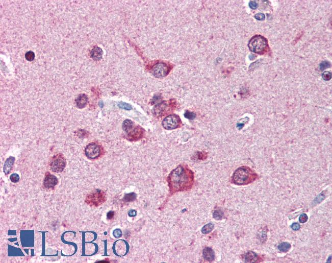Anti-LRRFIP1 antibody IHC of human brain, cortex. Immunohistochemistry of formalin-fixed, paraffin-embedded tissue after heat-induced antigen retrieval. Antibody LS-B3098 concentration 5 ug/ml.