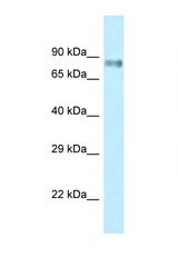 LRRFIP1 antibody LS-C145924 Western blot of Small Intestine lysate. Antibody concentration 1 ug/ml.