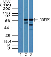 Western blot of LRRFIP1 in human heart lysate using 1) pre-bleed and 2) LS-C148697, and LS-C148697 in 3) mouse heart lysate at 3 and 5 ug/ml, respectively. Goat anti-rabbit Ig HRP secondary antibody, and PicoTect ECL substrate solution, were used for this test.