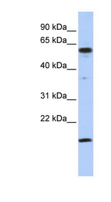 TRIP10 / CIP4 antibody LS-C110274 Western blot of Jurkat lysate.