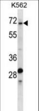 TRIP10 Antibody western blot of K562 cell line lysates (35 ug/lane). The TRIP10 antibody detected the TRIP10 protein (arrow).