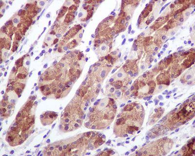 IHC of paraffin-embedded human stomach tissue using anti-CIP4 antibody.