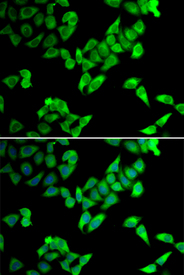 Immunofluorescence blot of U20S cell using TRIP10 antibody. Blue: DAPI for nuclear staining.