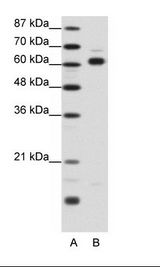 A: Marker, B: 293T Cell Lysate