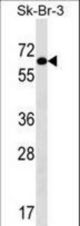 TRIP4 Antibody western blot of SK-BR-3 cell line lysates (35 ug/lane). The TRIP4 antibody detected the TRIP4 protein (arrow).