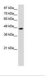 Jurkat Cell Lysate