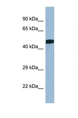 TRIT1 antibody LS-C145481 Western blot of Mouse Kidney lysate. Antibody concentration 1 ug/ml.