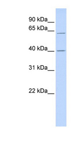 TRIT1 antibody LS-C101417 Western blot of Fetal Heart lysate.