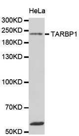 Western blot analysis of extracts of HeLa cell line, using TARBP1 antibody.