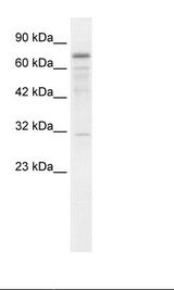 Jurkat Cell Lysate