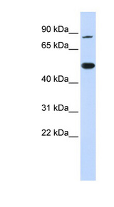 TRMT1 antibody LS-C109931 Western blot of 293T cell lysate.