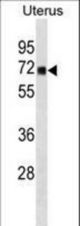 TRMT1 Antibody western blot of human Uterus tissue lysates (35 ug/lane). The TRMT1 antibody detected the TRMT1 protein (arrow).