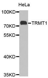 Western blot analysis of extracts of HeLa cell lines, using TRMT1 antibody.