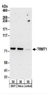 Detection of Human TRMT1 by Western Blot. Samples: Whole cell lysate (50 ug) from 293T, HeLa, and Jurkat cells. Antibodies: Affinity purified rabbit anti-TRMT1 antibody used for WB at 1 ug/ml. Detection: Chemiluminescence with an exposure time of 3 minutes.