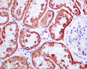IHC of paraffin-embedded human kidney tissue using anti-TRMT1 antibody.