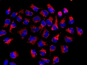 Immunofluorescent staining of HeLa cells using anti-TRMT1 antibody.