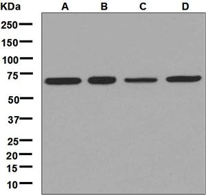 Western blot analysis on (A) HeLa, (B) PC-3, (C) Jurkat, and (D) Caco-2 cell lysates using anti-TRMT1 antibody.