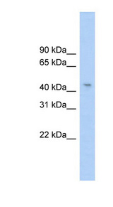 RG9MTD1 antibody LS-C116185 Western blot of HeLa lysate.