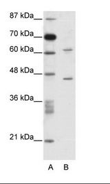 A: Marker, B: Jurkat Cell Lysate