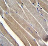 TRMT2B Antibody immunohistochemistry of formalin-fixed and paraffin-embedded human skeletal muscle followed by peroxidase-conjugated secondary antibody and DAB staining.