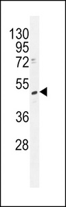 TRMT2B Antibody western blot of K562 cell line lysates (35 ug/lane). The TRMT2B antibody detected the TRMT2B protein (arrow).