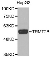 Western blot analysis of extracts of HepG2 cell line, using TRMT2B antibody.