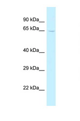 TRMT5 antibody LS-C145697 Western blot of Mouse Liver lysate. Antibody concentration 1 ug/ml.