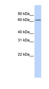 TRMT5 antibody LS-C102324 Western blot of MCF7 cell lysate.