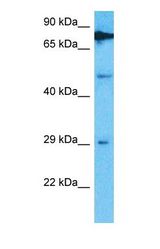 Western blot of TRMT61B Antibody with human HeLa Whole Cell lysate.