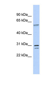 TRNAU1AP / TRSPAP1 antibody LS-C110580 Western blot of Fetal Intestine lysate.