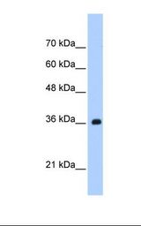 Jurkat cell lysate. Antibody concentration: 1.25 ug/ml. Gel concentration: 12%.
