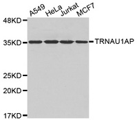 Western blot analysis of extracts of various cell lines, using TRNAU1AP antibody.