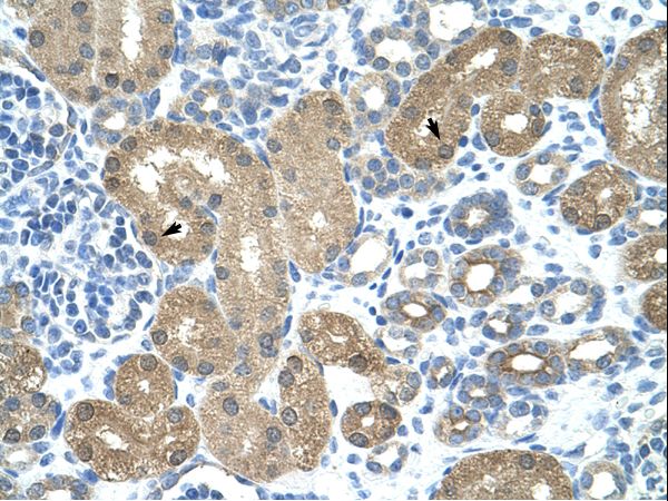 TRNT1 antibody LS-C31611 was used in IHC to stain formalin-fixed, paraffin-embedded human kidney.