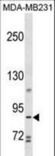 TROAP Antibody western blot of MDA-MB231 cell line lysates (35 ug/lane). The TROAP antibody detected the TROAP protein (arrow).