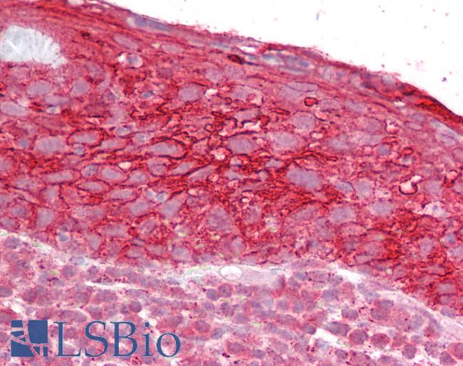 Anti-TROP2 antibody IHC of human tonsil. Immunohistochemistry of formalin-fixed, paraffin-embedded tissue after heat-induced antigen retrieval. Antibody LS-B6478 concentration 2.5 ug/ml.