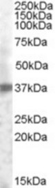 Antibody (0.2 ug/ml) staining of Human Prostate lysate (35 ug protein in RIPA buffer). Primary incubation was 1 hour. Detected by chemiluminescence.