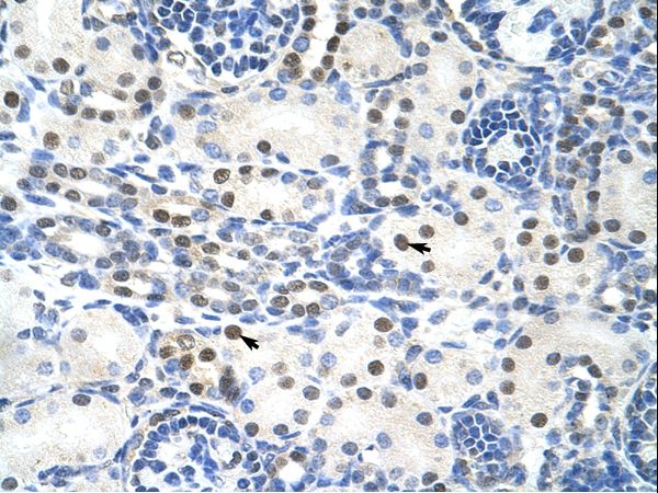 TROVE2 antibody LS-C31684 was used in IHC to stain formalin-fixed, paraffin-embedded human kidney.