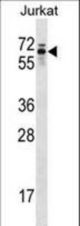 TROVE2 Antibody western blot of Jurkat cell line lysates (35 ug/lane). The TROVE2 antibody detected the TROVE2 protein (arrow).