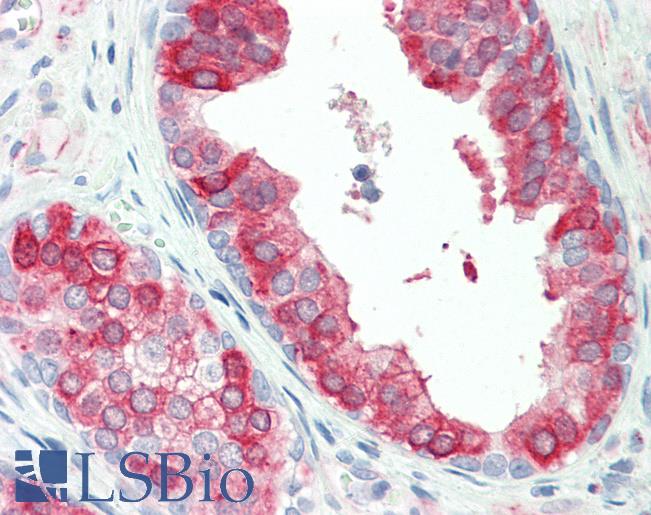 Human, Prostate:Formalin-Fixed Paraffin-Embedded (FFPE)