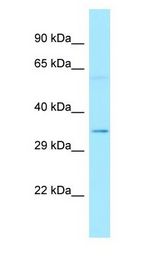 TRP32 / TXNL1 antibody Western Blot of Fetal Lung.