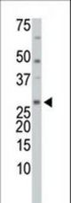 The anti-TrxL antibody is used in Western blot to detect TrxL in HL-60 cell lysate.