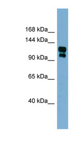 TRPA1 antibody LS-C107881 Western blot of Fetal Stomach lysate.