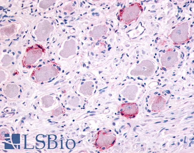 Anti-TRPA1 antibody LS-A9097 IHC of human ganglion cells. Immunohistochemistry of formalin-fixed, paraffin-embedded tissue after heat-induced antigen retrieval.
