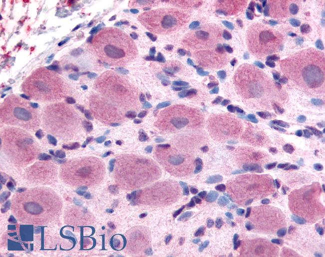 Anti-TRPA1 antibody LS-A9098 IHC of human spinal cord, dorsal root ganglion. Immunohistochemistry of formalin-fixed, paraffin-embedded tissue after heat-induced antigen retrieval.