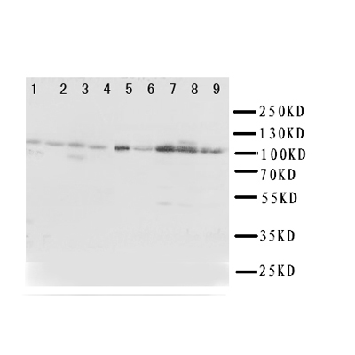 WB of TRPC3 antibody. Lane 1: Rat Liver Tissue Lysate. Lane 2: Rat Lung Tissue Lysate. Lane 3: Rat Intestine Tissue Lysate. Lane 4: Rat Ovary Tissue Lysate. Lane 5: U87 Cell Lysate. Lane 6: A549 Cell Lysate. Lane 7: COLO320 Cell Lysate. Lane 8: SW620 Cell Lysate. Lane 9: HELA Cell Lysate.