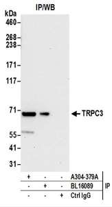 Detection of Human TRPC3 by Western Blot of Immunoprecipitates. Samples: Whole cell lysate (0.5 or 1.0 mg per IP reaction; 20% of IP loaded) prepared using NETN buffer from 293T cells. Antibodies: Affinity purified rabbit anti-TRPC3 antibody used for IP at 6 ug per reaction. TRPC3 was also immunoprecipitated by rabbit anti-TRPC3 antibody BL16089. For blotting immunoprecipitated TRPC3, was used at 1 ug/ml. Detection: Chemiluminescence with an exposure time of 30 seconds.
