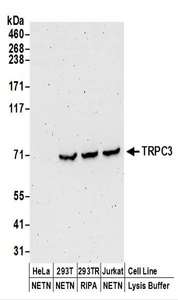 Detection of Human TRPC3 by Western Blot. Samples: Whole cell lysate (50 ug) prepared using NETN or RIPA buffer from HeLa, 293T, and Jurkat cells. Antibodies: Affinity purified rabbit anti-TRPC3 antibody used for WB at 0.1 ug/ml. Detection: Chemiluminescence with an exposure time of 3 minutes.
