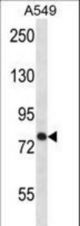 TRPC3 Antibody western blot of A549 cell line lysates (35 ug/lane). The TRPC3 antibody detected the TRPC3 protein (arrow).